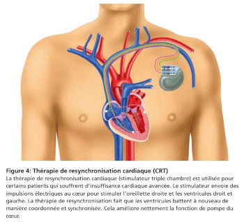coeur 4